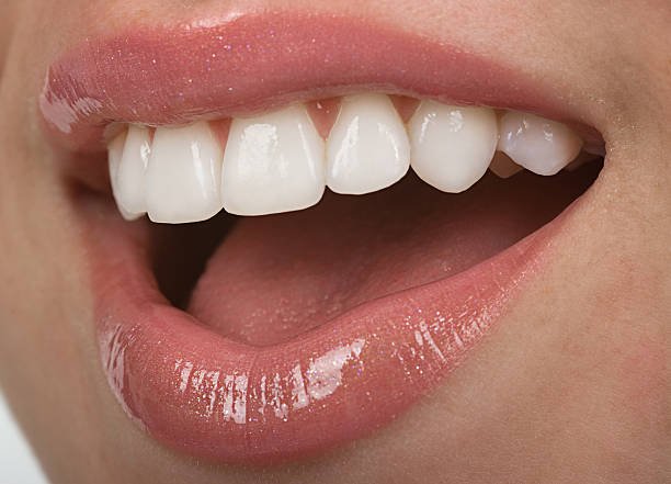 Teeth Whitening Solihull